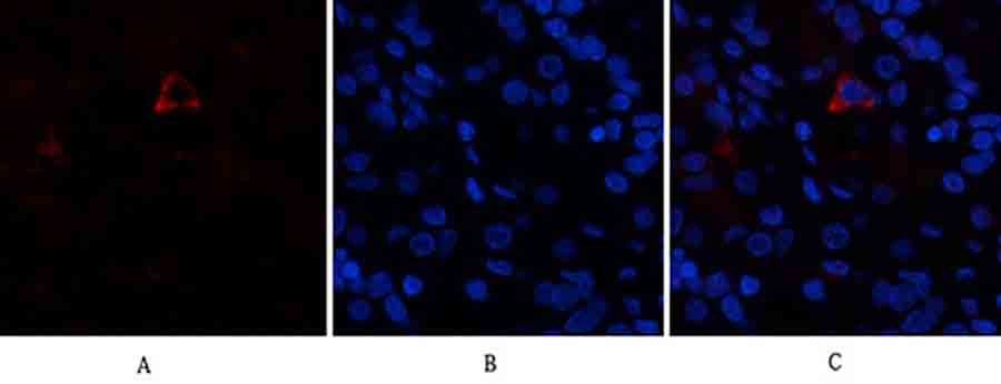 Fig.1. Immunofluorescence analysis of human stomach tissue. 1, AR Polyclonal Antibody (red) was diluted at 1:200 (4°C, overnight). 2, Cy3 Labeled secondary antibody was diluted at 1:300 (room temperature, 50min). 3, Picture B: DAPI (blue) 10min. Picture A: Target. Picture B: DAPI. Picture C: merge of A+B.