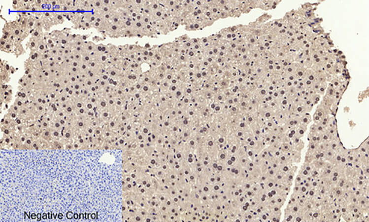 Fig.4. Immunohistochemical analysis of paraffin-embedded mouse liver tissue. 1, AR Polyclonal Antibody was diluted at 1:200 (4°C, overnight). 2, Sodium citrate pH 6.0 was used for antibody retrieval (>98°C, 20min). 3, secondary antibody was diluted at 1:200 (room temperature, 30min). Negative control was used by secondary antibody only.