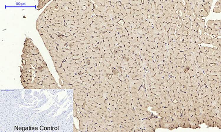 Fig.5. Immunohistochemical analysis of paraffin-embedded rat heart tissue. 1, AR Polyclonal Antibody was diluted at 1:200 (4°C, overnight). 2, Sodium citrate pH 6.0 was used for antibody retrieval (>98°C, 20min). 3, secondary antibody was diluted at 1:200 (room temperature, 30min). Negative control was used by secondary antibody only.
