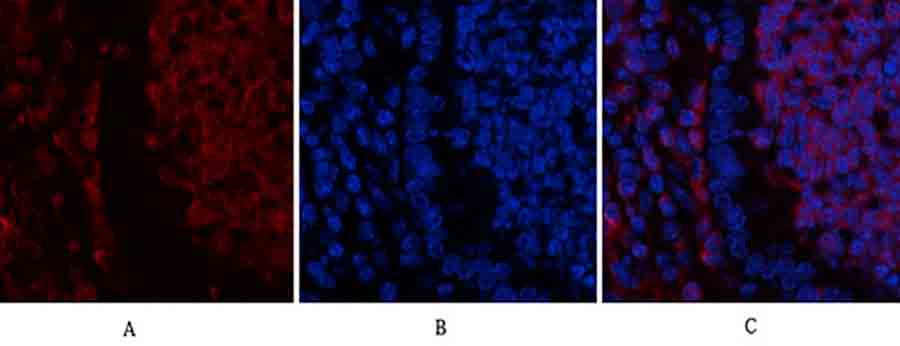 Fig.3. Immunofluorescence analysis of mouse spleen tissue. 1, Ub Polyclonal Antibody (red) was diluted at 1:200 (4°C, overnight). 2, Cy3 Labeled secondary antibody was diluted at 1:300 (room temperature, 50min). 3, Picture B: DAPI (blue) 10min. Picture A: Target. Picture B: DAPI. Picture C: merge of A+B.
