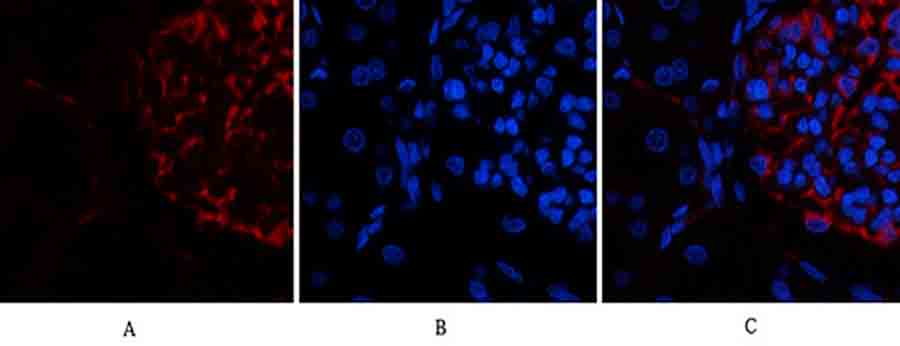 Fig.4. Immunofluorescence analysis of rat kidney tissue. 1, Ub Polyclonal Antibody (red) was diluted at 1:200 (4°C, overnight). 2, Cy3 Labeled secondary antibody was diluted at 1:300 (room temperature, 50min). 3, Picture B: DAPI (blue) 10min. Picture A: Target. Picture B: DAPI. Picture C: merge of A+B.