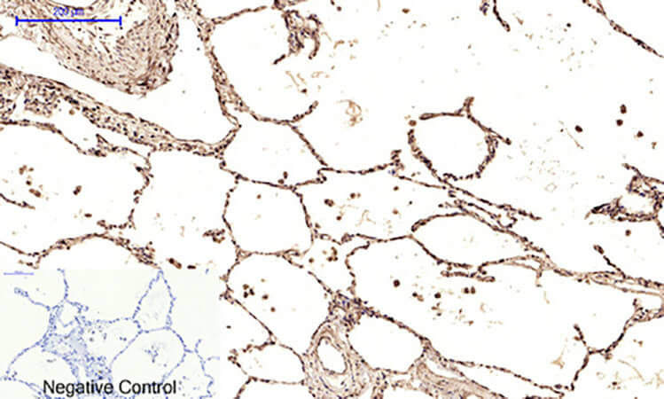 Fig.5. Immunohistochemical analysis of paraffin-embedded human lung tissue. 1, Ub Polyclonal Antibody was diluted at 1:200 (4°C, overnight). 2, Sodium citrate pH 6.0 was used for antibody retrieval (>98°C, 20min). 3, secondary antibody was diluted at 1:200 (room temperature, 30min). Negative control was used by secondary antibody only.