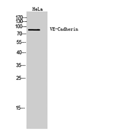 Fig.1. Western Blot analysis of Hela cells using VE-Cadherin Polyclonal Antibody. Antibody was diluted at 1:500.