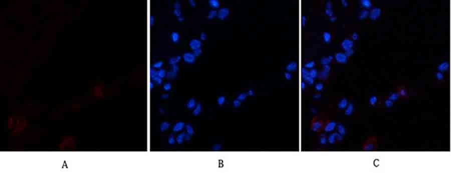 Fig.2. Immunofluorescence analysis of human lung tissue. 1, VE-Cadherin Polyclonal Antibody (red) was diluted at 1:200 (4°C, overnight). 2, Cy3 Labeled secondary antibody was diluted at 1:300 (room temperature, 50min). 3, Picture B: DAPI (blue) 10min. Picture A: Target. Picture B: DAPI. Picture C: merge of A+B.