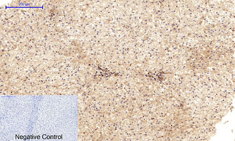 Fig.4. Immunohistochemical analysis of paraffin-embedded human liver tissue. 1, VE-Cadherin Polyclonal Antibody was diluted at 1:200 (4°C, overnight). 2, Sodium citrate pH 6.0 was used for antibody retrieval (>98°C, 20min). 3, secondary antibody was diluted at 1:200 (room temperature, 30min). Negative control was used by secondary antibody only.