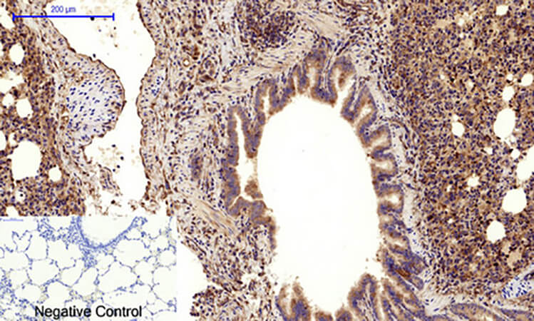 Fig.6. Immunohistochemical analysis of paraffin-embedded rat lung tissue. 1, VE-Cadherin Polyclonal Antibody was diluted at 1:200 (4°C, overnight). 2, Sodium citrate pH 6.0 was used for antibody retrieval (>98°C, 20min). 3, secondary antibody was diluted at 1:200 (room temperature, 30min). Negative control was used by secondary antibody only.