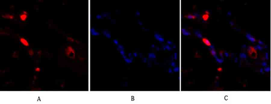 Fig.1. Immunofluorescence analysis of human lung tissue. 1, p38 Polyclonal Antibody (red) was diluted at 1:200 (4°C, overnight). 2, Cy3 Labeled secondary antibody was diluted at 1:300 (room temperature, 50min). 3, Picture B: DAPI (blue) 10min. Picture A: Target. Picture B: DAPI. Picture C: merge of A+B.