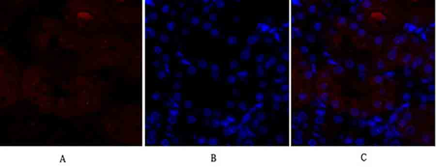 Fig.3. Immunofluorescence analysis of rat kidney tissue. 1, p38 Polyclonal Antibody (red) was diluted at 1:200 (4°C, overnight). 2, Cy3 Labeled secondary antibody was diluted at 1:300 (room temperature, 50min). 3, Picture B: DAPI (blue) 10min. Picture A: Target. Picture B: DAPI. Picture C: merge of A+B.