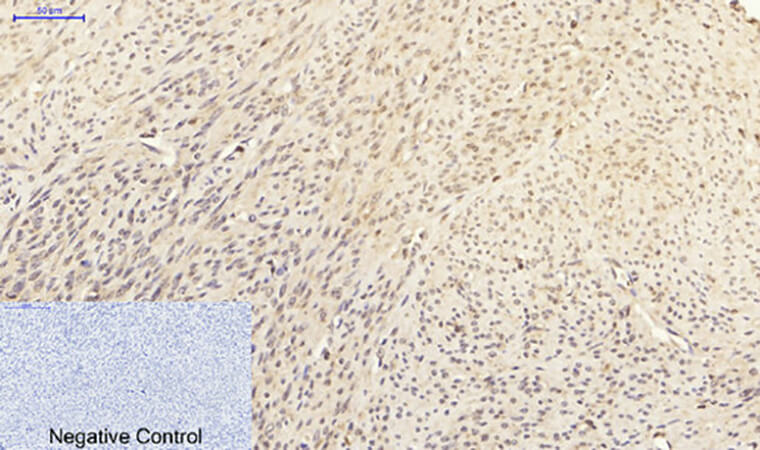 Fig.4. Immunohistochemical analysis of paraffin-embedded human uterus tissue. 1, p38 Polyclonal Antibody was diluted at 1:200 (4°C, overnight). 2, Sodium citrate pH 6.0 was used for antibody retrieval (>98°C, 20min). 3, secondary antibody was diluted at 1:200 (room temperature, 30min). Negative control was used by secondary antibody only.