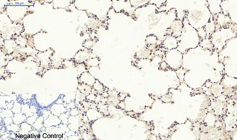Fig.6. Immunohistochemical analysis of paraffin-embedded rat lung tissue. 1, p38 Polyclonal Antibody was diluted at 1:200 (4°C, overnight). 2, Sodium citrate pH 6.0 was used for antibody retrieval (>98°C, 20min). 3, secondary antibody was diluted at 1:200 (room temperature, 30min). Negative control was used by secondary antibody only.