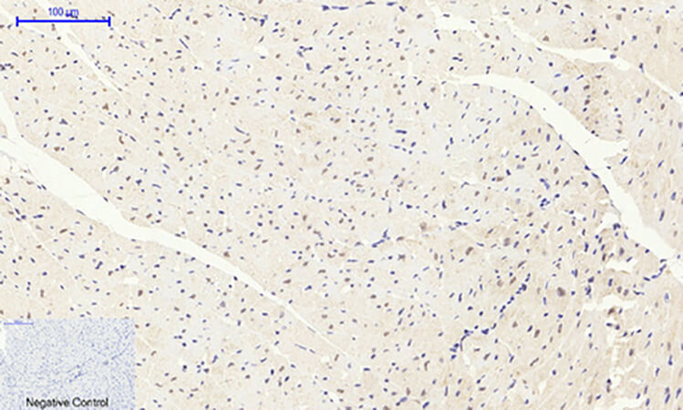 Fig.3. Immunohistochemical analysis of paraffin-embedded mouse heart tissue. 1, FoxO1 Polyclonal Antibody was diluted at 1:200 (4°C, overnight). 2, Sodium citrate pH 6.0 was used for antibody retrieval (>98°C, 20min). 3, secondary antibody was diluted at 1:200 (room temperature, 30min). Negative control was used by secondary antibody only.