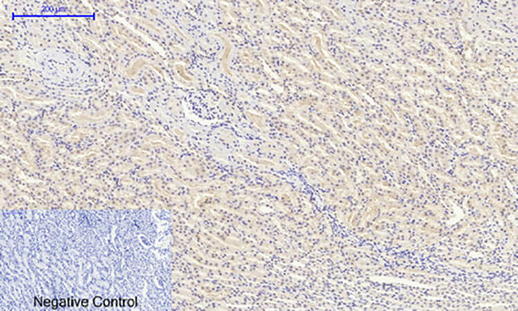 Fig.4. Immunohistochemical analysis of paraffin-embedded rat kidney tissue. 1, FoxO1 Polyclonal Antibody was diluted at 1:200 (4°C, overnight). 2, Sodium citrate pH 6.0 was used for antibody retrieval (>98°C, 20min). 3, secondary antibody was diluted at 1:200 (room temperature, 30min). Negative control was used by secondary antibody only.
