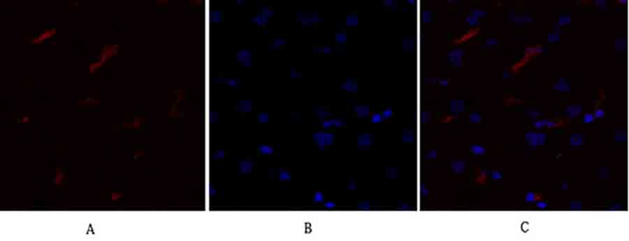 Fig.1. Immunofluorescence analysis of human liver tissue. 1, mTOR Polyclonal Antibody (red) was diluted at 1:200 (4°C, overnight). 2, Cy3 Labeled secondary antibody was diluted at 1:300 (room temperature, 50min). 3, Picture B: DAPI (blue) 10min. Picture A: Target. Picture B: DAPI. Picture C: merge of A+B.