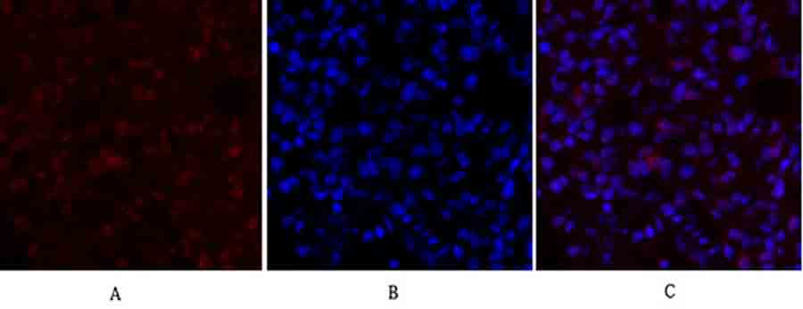 Fig.2. Immunofluorescence analysis of rat lung tissue. 1, mTOR Polyclonal Antibody (red) was diluted at 1:200 (4°C, overnight). 2, Cy3 Labeled secondary antibody was diluted at 1:300 (room temperature, 50min). 3, Picture B: DAPI (blue) 10min. Picture A: Target. Picture B: DAPI. Picture C: merge of A+B.