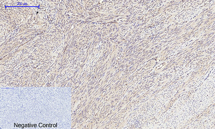 Fig.3. Immunohistochemical analysis of paraffin-embedded human uterus tissue. 1, mTOR Polyclonal Antibody was diluted at 1:200 (4°C, overnight). 2, Sodium citrate pH 6.0 was used for antibody retrieval (>98°C, 20min). 3, secondary antibody was diluted at 1:200 (room temperature, 30min). Negative control was used by secondary antibody only.