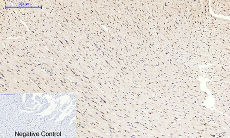 Fig.5. Immunohistochemical analysis of paraffin-embedded rat heart tissue. 1, mTOR Polyclonal Antibody was diluted at 1:200 (4°C, overnight). 2, Sodium citrate pH 6.0 was used for antibody retrieval (>98°C, 20min). 3, secondary antibody was diluted at 1:200 (room temperature, 30min). Negative control was used by secondary antibody only.