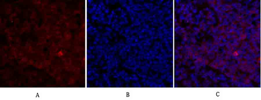 Fig.1. Immunofluorescence analysis of mouse lung tissue. 1, Survivin Polyclonal Antibody (red) was diluted at 1:200 (4°C, overnight). 2, Cy3 Labeled secondary antibody was diluted at 1:300 (room temperature, 50min). 3, Picture B: DAPI (blue) 10min. Picture A: Target. Picture B: DAPI. Picture C: merge of A+B.