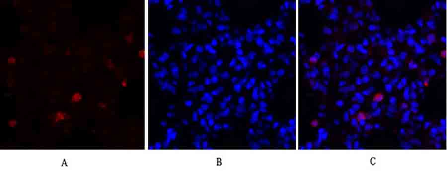 Fig.2. Immunofluorescence analysis of rat lung tissue. 1, Survivin Polyclonal Antibody (red) was diluted at 1:200 (4°C, overnight). 2, Cy3 Labeled secondary antibody was diluted at 1:300 (room temperature, 50min). 3, Picture B: DAPI (blue) 10min. Picture A: Target. Picture B: DAPI. Picture C: merge of A+B.