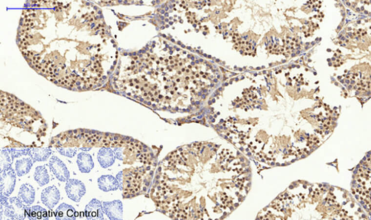 Fig.4. Immunohistochemical analysis of paraffin-embedded mouse testis tissue. 1, Survivin Polyclonal Antibody was diluted at 1:200 (4°C, overnight). 2, Sodium citrate pH 6.0 was used for antibody retrieval (>98°C, 20min). 3, secondary antibody was diluted at 1:200 (room temperature, 30min). Negative control was used by secondary antibody only.