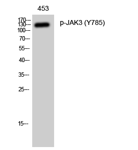 Fig. Western Blot analysis of 453 cells using Phospho-JAK3 (Y785) Polyclonal Antibody diluted at 1:1000.