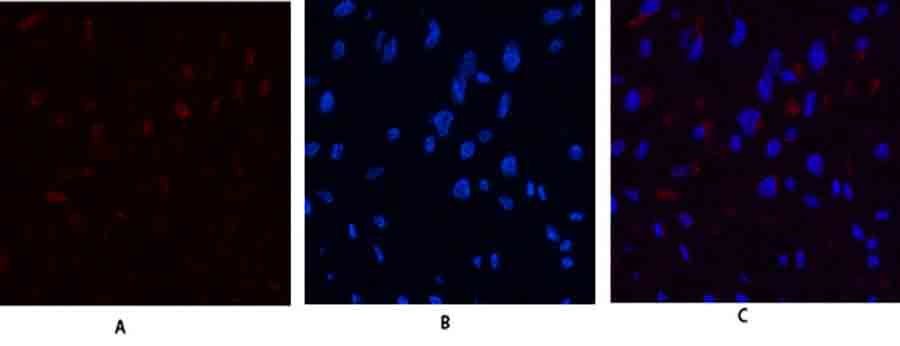Fig.1. Immunofluorescence analysis of human uterus tissue. 1, JAK3 Polyclonal Antibody (red) was diluted at 1:200 (4°,overnight). 2, Cy3 Labeled secondary antibody was diluted at 1:300 (room temperature, 50min). 3, Picture B: DAPI (blue) 10min. Picture A: Target. Picture B: DAPI. Picture C: merge of A+B.