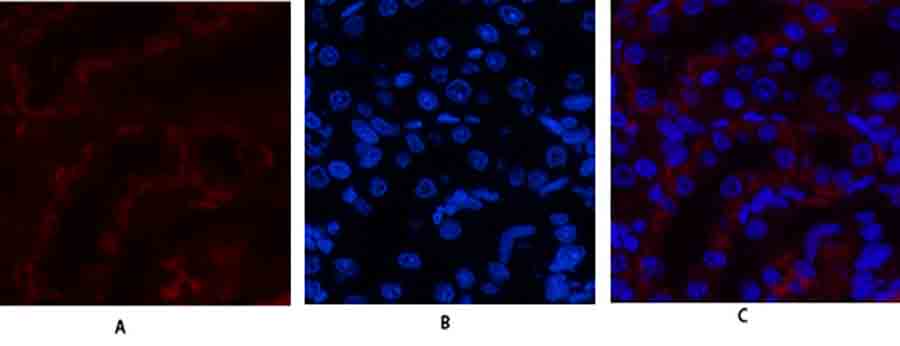 Fig.2. Immunofluorescence analysis of rat kidney tissue. 1, JAK3 Polyclonal Antibody (red) was diluted at 1:200 (4°,overnight). 2, Cy3 Labeled secondary antibody was diluted at 1:300 (room temperature, 50min). 3, Picture B: DAPI (blue) 10min. Picture A: Target. Picture B: DAPI. Picture C: merge of A+B.