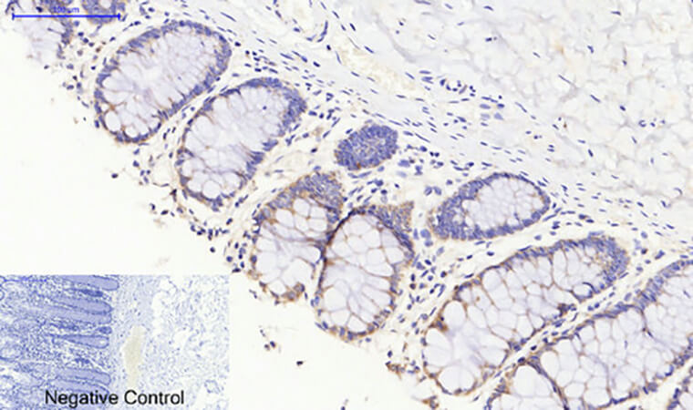Fig.4. Immunohistochemical analysis of paraffin-embedded human colon tissue. 1, JAK3 Polyclonal Antibody was diluted at 1:200 (4°C, overnight). 2, Sodium citrate pH 6.0 was used for antibody retrieval (>98°C, 20min). 3, secondary antibody was diluted at 1:200 (room temperature, 30min). Negative control was used by secondary antibody only.