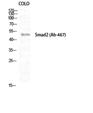 Fig.1. Western Blot analysis of COLO cells using Smad2 Polyclonal Antibody diluted at 1:1000.