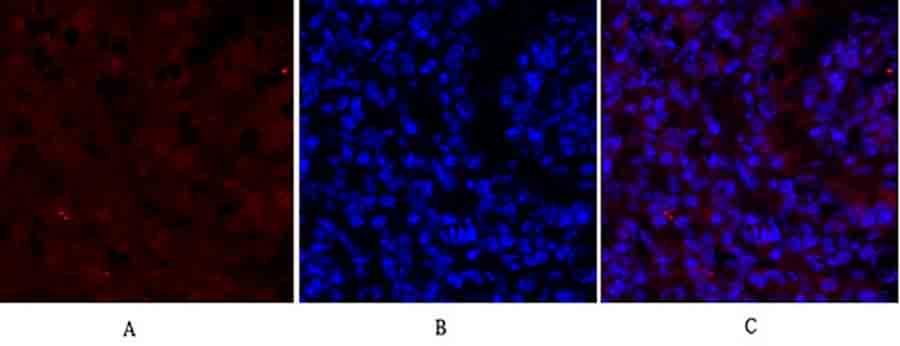Fig.2. Immunofluorescence analysis of Mouse lung tissue. 1,  Smad2 Polyclonal Antibody (red) was diluted at 1:200 (4°C, overnight). 2,  Cy3 labled secondary antibody was diluted at 1:300 (room temperature, 50min). 3, Picture B: DAPI (blue) 10min. Picture A: Target. Picture B: DAPI. Picture C: merge of A+B.