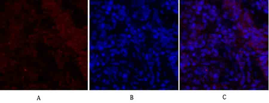 Fig.3. Immunofluorescence analysis of rat lung tissue. 1,  Smad2 Polyclonal Antibody (red) was diluted at 1:200 (4°C, overnight). 2,  Cy3 labled secondary antibody was diluted at 1:300 (room temperature, 50min). 3, Picture B: DAPI (blue) 10min. Picture A: Target. Picture B: DAPI. Picture C: merge of A+B.