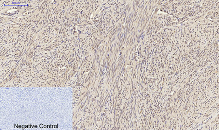Fig.4. Immunohistochemical analysis of paraffin-embedded human uterus tissue. 1,  Smad2 Polyclonal Antibody was diluted at 1:200 (4°C, overnight). 2,  Sodium citrate pH 6.0 was used for antibody retrieval (>98°C, 20min). 3, secondary antibody was diluted at 1:200 (room temperature, 30min). Negative control was used by secondary antibody only.