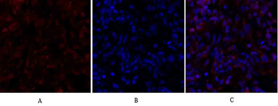 Fig.2. Immunofluorescence analysis of rat lung tissue. 1, Smad4 Polyclonal Antibody (red) was diluted at 1:200 (4°C, overnight). 2, Cy3 Labeled secondary antibody was diluted at 1:300 (room temperature, 50min). 3, Picture B: DAPI (blue) 10min. Picture A: Target. Picture B: DAPI. Picture C: merge of A+B.