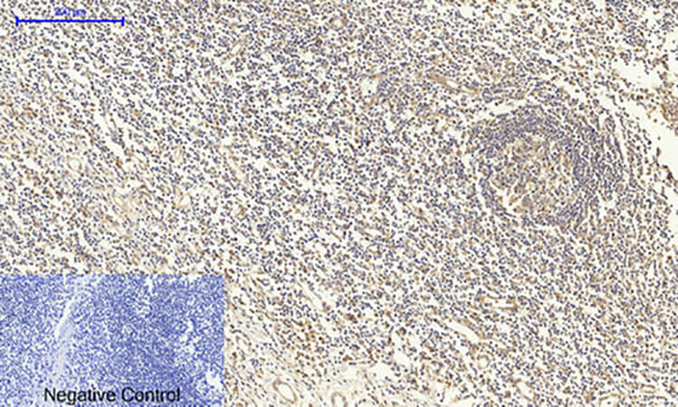 Fig.3. Immunohistochemical analysis of paraffin-embedded human tonsil tissue. 1, Smad4 Polyclonal Antibody was diluted at 1:200 (4°C, overnight). 2, Sodium citrate pH 6.0 was used for antibody retrieval (>98°C, 20min). 3, secondary antibody was diluted at 1:200 (room temperature, 30min). Negative control was used by secondary antibody only.