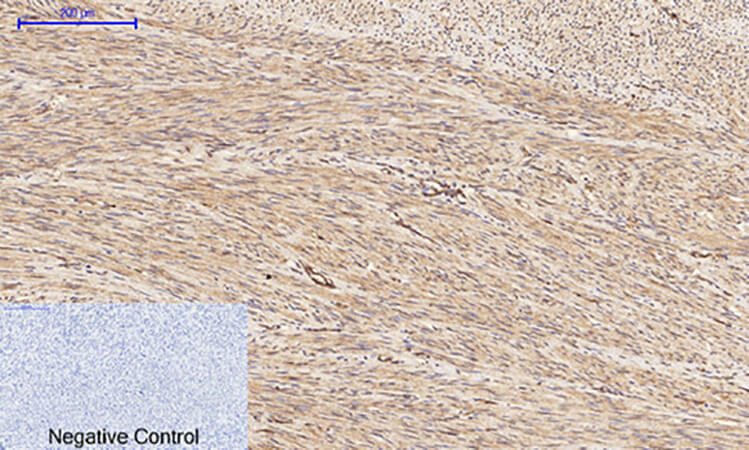 Fig.2. Immunohistochemical analysis of paraffin-embedded human uterus tissue. 1,  PI 3-kinase p85/p55 (phospho Tyr467/199) Polyclonal Antibody was diluted at 1:200 (4°C, overnight). 2,  Sodium citrate pH 6.0 was used for antibody retrieval (>98°C, 20min). 3, secondary antibody was diluted at 1:200 (room temperature, 30min). Negative control was used by secondary antibody only.
