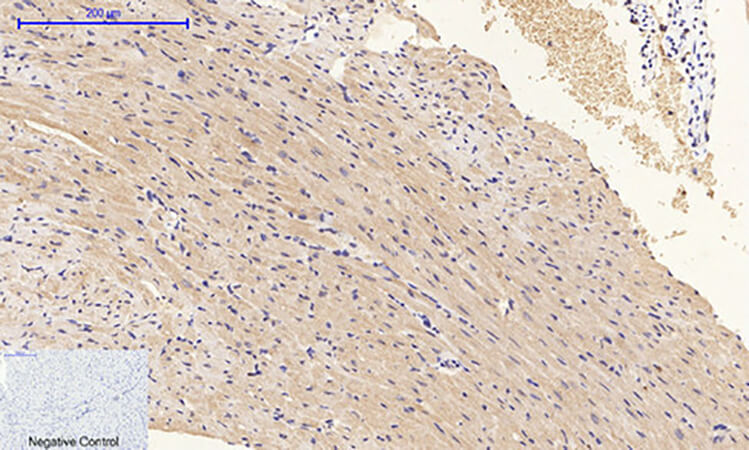 Fig.3. Immunohistochemical analysis of paraffin-embedded Mouse heart tissue. 1,  PI 3-kinase p85/p55 (phospho Tyr467/199) Polyclonal Antibody was diluted at 1:200 (4°C, overnight). 2,  Sodium citrate pH 6.0 was used for antibody retrieval (>98°C, 20min). 3, secondary antibody was diluted at 1:200 (room temperature, 30min). Negative control was used by secondary antibody only.