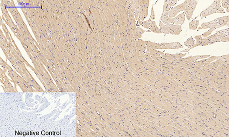 Fig.4. Immunohistochemical analysis of paraffin-embedded rat heart tissue. 1,  PI 3-kinase p85/p55 (phospho Tyr467/199) Polyclonal Antibody was diluted at 1:200 (4°C, overnight). 2,  Sodium citrate pH 6.0 was used for antibody retrieval (>98°C, 20min). 3, secondary antibody was diluted at 1:200 (room temperature, 30min). Negative control was used by secondary antibody only.