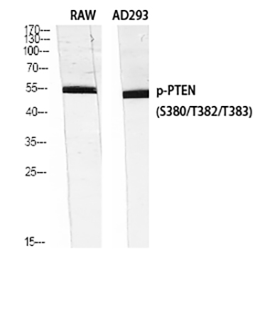 Fig.4. Western Blot analysis of RAW (1), AD293 (2), diluted at 1:1000.