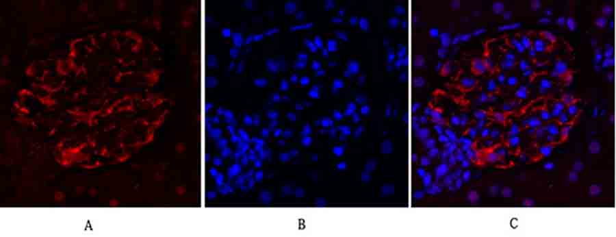 Fig.2. Immunofluorescence analysis of rat kidney tissue. 1, FAK Polyclonal Antibody (red) was diluted at 1:200 (4°C, overnight). 2, Cy3 Labeled secondary antibody was diluted at 1:300 (room temperature, 50min). 3, Picture B: DAPI (blue) 10min. Picture A: Target. Picture B: DAPI. Picture C: merge of A+B.