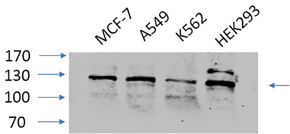 Fig.3. Western Blot analysis of MCF-7 (1), A549 (2), K562 (3), HEK293 (4), diluted at 1:1000.
