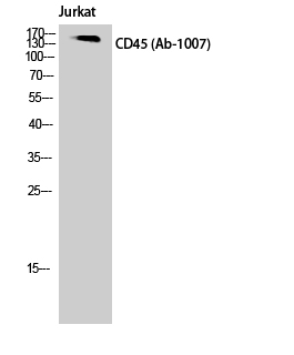 Fig. Western Blot analysis of Jurkat cells using CD45 Polyclonal Antibody.