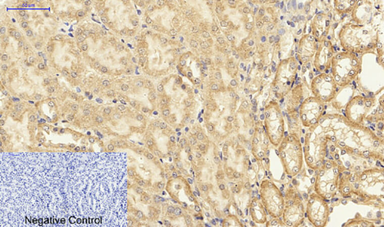 Fig.3. Immunohistochemical analysis of paraffin-embedded mouse kidney tissue. 1, NFκB-p65 Polyclonal Antibody was diluted at 1:200 (4°C, overnight). 2, Sodium citrate pH 6.0 was used for antibody retrieval (>98°C, 20min). 3, secondary antibody was diluted at 1:200 (room temperature, 30min). Negative control was used by secondary antibody only.