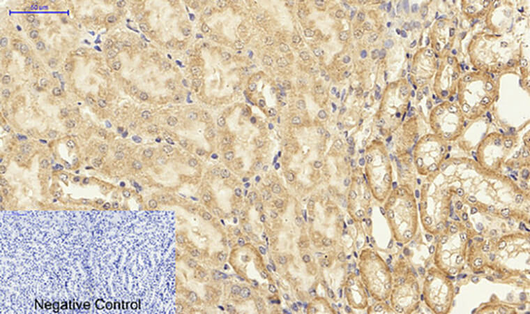 Fig.3. Immunohistochemical analysis of paraffin-embedded mouse kidney tissue. 1, NFκB-p65 Polyclonal Antibody was diluted at 1:200 (4°C, overnight). 2, Sodium citrate pH 6.0 was used for antibody retrieval (>98°C, 20min). 3, secondary antibody was diluted at 1:200 (room temperature, 30min). Negative control was used by secondary antibody only.