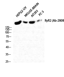 Fig. Western Blot analysis of HepG2-UV Mouse-BRAIN AD293 PC-3 cells using RyR-2 Polyclonal Antibody diluted at 1:2000.