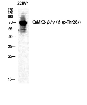 Fig.1. Western Blot analysis of 22RV1 cells using Phospho-CaMKIIβ/γ/δ (T287) Polyclonal Antibody diluted at 1:500.