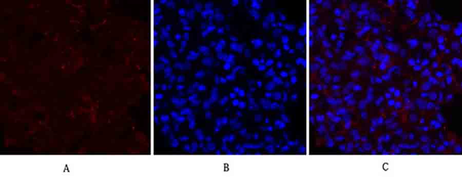 Fig.2. Immunofluorescence analysis of rat lung tissue. 1, PERK Polyclonal Antibody (red) was diluted at 1:200 (4°C, overnight). 2, Cy3 Labeled secondary antibody was diluted at 1:300 (room temperature, 50min). 3, Picture B: DAPI (blue) 10min. Picture A: Target. Picture B: DAPI. Picture C: merge of A+B.