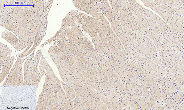 Fig.4. Immunohistochemical analysis of paraffin-embedded mouse heart tissue. 1, PERK Polyclonal Antibody was diluted at 1:200 (4°C, overnight). 2, Sodium citrate pH 6.0 was used for antibody retrieval (>98°C, 20min). 3, secondary antibody was diluted at 1:200 (room temperature, 30min). Negative control was used by secondary antibody only.