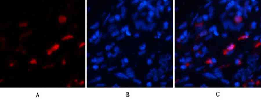 Fig.2. Immunofluorescence analysis of human liver tissue. 1, BMP-2 Polyclonal Antibody (red) was diluted at 1:200 (4°C, overnight). 2, Cy3 Labeled secondary antibody was diluted at 1:300 (room temperature, 50min). 3, Picture B: DAPI (blue) 10min. Picture A: Target. Picture B: DAPI. Picture C: merge of A+B.