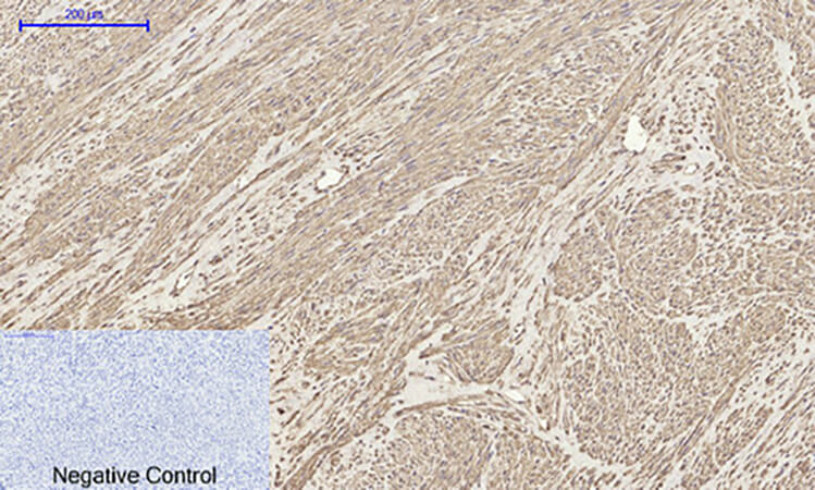 Fig.4. Immunohistochemical analysis of paraffin-embedded human uterus tissue. 1, BMP-2 Polyclonal Antibody was diluted at 1:200 (4°C, overnight). 2, Sodium citrate pH 6.0 was used for antibody retrieval (>98°C, 20min). 3, secondary antibody was diluted at 1:200 (room temperature, 30min). Negative control was used by secondary antibody only.
