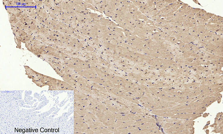 Fig.6. Immunohistochemical analysis of paraffin-embedded rat heart tissue. 1, BMP-2 Polyclonal Antibody was diluted at 1:200 (4°C, overnight). 2, Sodium citrate pH 6.0 was used for antibody retrieval (>98°C, 20min). 3, secondary antibody was diluted at 1:200 (room temperature, 30min). Negative control was used by secondary antibody only.