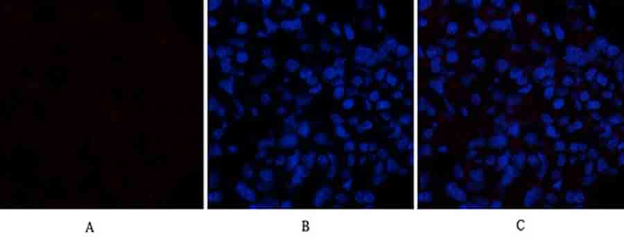 Fig.1. Immunofluorescence analysis of rat lung tissue. 1, Caspase-1 Polyclonal Antibody (red) was diluted at 1:200 (4°C, overnight). 2, Cy3 Labeled secondary antibody was diluted at 1:300 (room temperature, 50min). 3, Picture B: DAPI (blue) 10min. Picture A: Target. Picture B: DAPI. Picture C: merge of A+B.